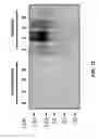 Fig. 19 - Detection of Misfolded Amyloid Beta Protein