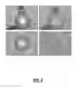 Fig. 05 - Methods and systems for super-resolution optical imaging using high-index of refraction microspheres and microcylinders