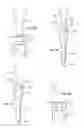 Fig. 05 - RFID tracking fastener