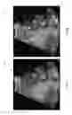 Fig. 07 - Systems and methods for selective enhancement of a region of interest in an image