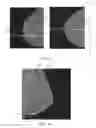 Fig. 08 - Image analysis for assessing image data