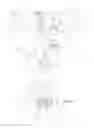 Fig. 02 - Active noise-control device