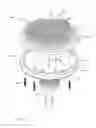 Fig. 03 - Electrostatic puck assembly with metal bonded backing plate for high temperature processes
