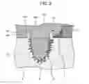 Fig. 10 - Semiconductor device