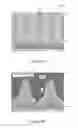 Fig. 10 - BSI image sensor and method of forming same