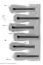 Fig. 03 - Hybrid energy storage devices including surface effect dominant sites