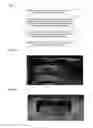 Fig. 03 - Image display method, vehicle display device, vehicle sun visor, and related vehicle