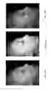 Fig. 15 - Systems and methods for spectral imaging with a transmitter using a plurality of light sources