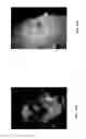 Fig. 16 - Systems and methods for spectral imaging with a transmitter using a plurality of light sources