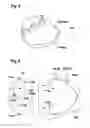 Fig. 04 - Oscillating gardening device, gear element of an oscillating gardening device and method using an oscillating gardening device