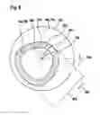 Fig. 06 - Oscillating gardening device, gear element of an oscillating gardening device and method using an oscillating gardening device
