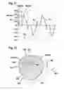 Fig. 08 - Oscillating gardening device, gear element of an oscillating gardening device and method using an oscillating gardening device