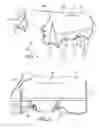 Fig. 02 - Horse Blanket with Insulative Insert