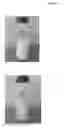 Fig. 02 - Fermented milk inoculated with both lactic acid bacteria (LAB) and 