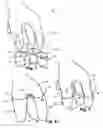 Fig. 02 - Glove