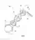 Fig. 07 - Wireform attachment mechanism
