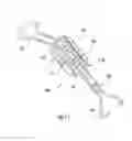 Fig. 11 - Wireform attachment mechanism