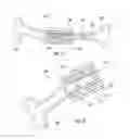Fig. 12 - Wireform attachment mechanism