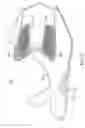 Fig. 41 - Composite upper for shoe with selectively disposed bonding agent