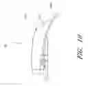 Fig. 17 - Reel based closure system