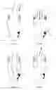 Fig. 04 - DEVICE FOR TAKING A GLOVE ON AND OFF, AND A GLOVE