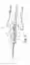 Fig. 02 - Medical device introduction and imaging system, and associated method