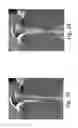 Fig. 17 - Medical device introduction and imaging system, and associated method