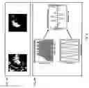 Fig. 07 - System and method for intraoperative detection of cancer margins using conformal filters in a dual polarization configuration