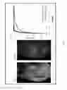 Fig. 08 - System and method for intraoperative detection of cancer margins using conformal filters in a dual polarization configuration
