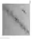 Fig. 04 - Body-worn sensor for characterizing patients with heart failure