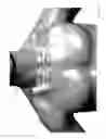 Fig. 06 - Body-worn sensor for characterizing patients with heart failure
