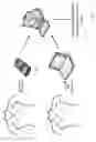 Fig. 10 - Body-worn sensor for characterizing patients with heart failure