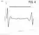 Fig. 05 - TRANSFER FUNCTION FOR TONOMETER SIGNALS