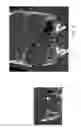 Fig. 03 - Seeing through mucus in an ENT procedure