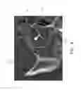 Fig. 07 - Seeing through mucus in an ENT procedure