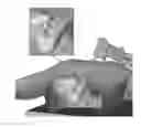 Fig. 01 - Universal instrument guide for robotic surgical systems, surgical instrument systems, and methods of their use