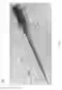 Fig. 13 - Universal instrument guide for robotic surgical systems, surgical instrument systems, and methods of their use