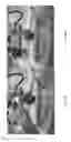 Fig. 15 - Universal instrument guide for robotic surgical systems, surgical instrument systems, and methods of their use