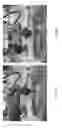 Fig. 16 - Universal instrument guide for robotic surgical systems, surgical instrument systems, and methods of their use
