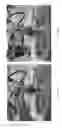 Fig. 18 - Universal instrument guide for robotic surgical systems, surgical instrument systems, and methods of their use