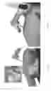Fig. 24 - Universal instrument guide for robotic surgical systems, surgical instrument systems, and methods of their use