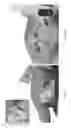 Fig. 25 - Universal instrument guide for robotic surgical systems, surgical instrument systems, and methods of their use