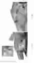 Fig. 26 - Universal instrument guide for robotic surgical systems, surgical instrument systems, and methods of their use