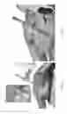 Fig. 30 - Universal instrument guide for robotic surgical systems, surgical instrument systems, and methods of their use