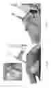 Fig. 33 - Universal instrument guide for robotic surgical systems, surgical instrument systems, and methods of their use