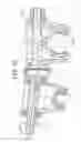 Fig. 13 - External fixator assembly