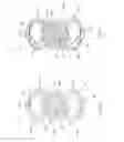 Fig. 15 - Dynamic fixation system, method of use, and fixation system attachment portions
