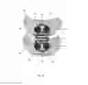 Fig. 23 - Dynamic fixation system, method of use, and fixation system attachment portions