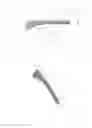 Fig. 25 - Dynamic fixation system, method of use, and fixation system attachment portions