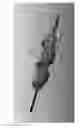 Fig. 50 - Continuous Flow Balloon Catheter Systems and Methods of Use